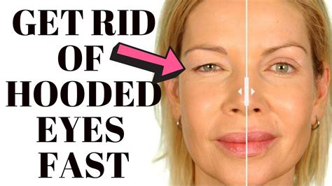 Free How To Fix Hooded Eyes Naturally For New Style
