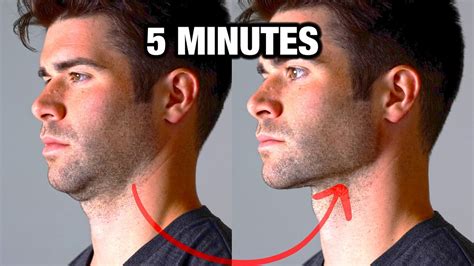how to get a jawline fast