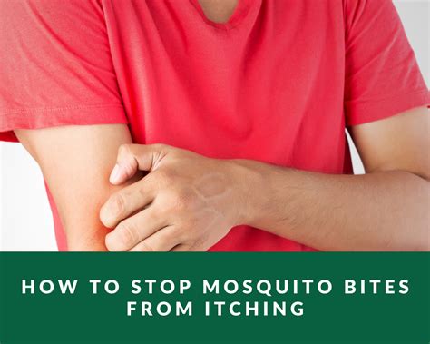 how to get a mosquito bite to stop itching