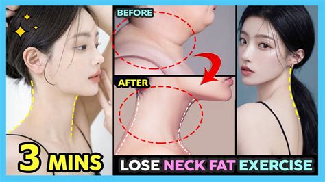 how to get a thinner neck reddit