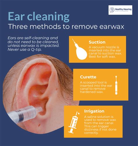 how to get ears cleaned