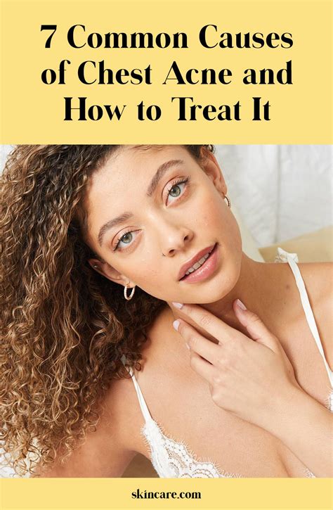 How To Get Rid Of A Chest Breakout