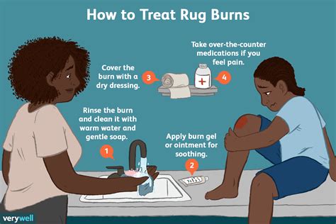 how to get rid of a rug burn fast