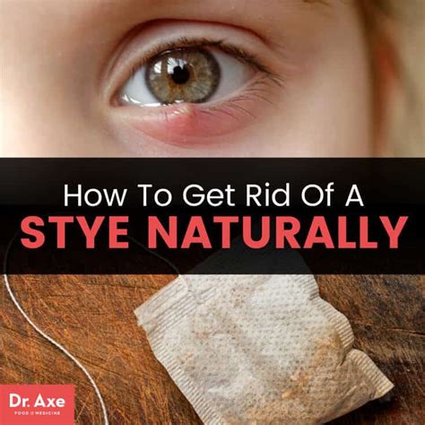 how to get rid of a stye on upper eyelid