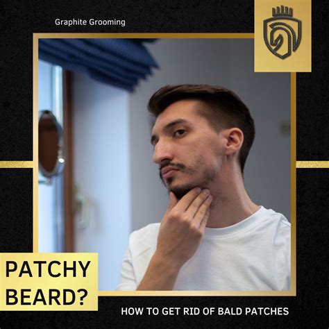 How To Get Rid Of Bald Patches In Beard  A Complete Guide