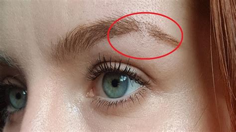 How To Get Rid Of Bald Patches In Eyebrows  A Complete Guide