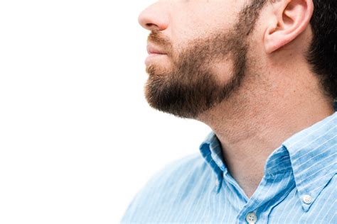 How To Get Rid Of Bald Patches In My Beard  A Comprehensive Guide