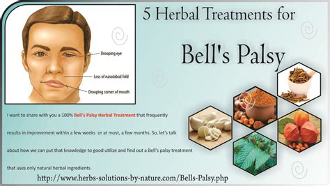 how to get rid of bells palsy