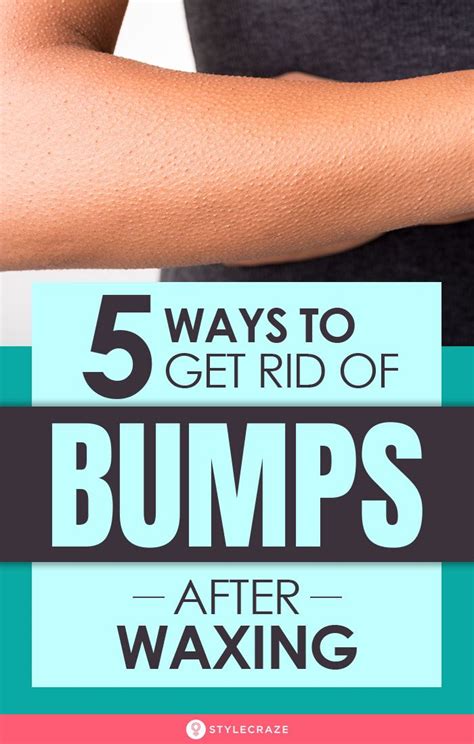 5 Home Remedies To Get Rid Of Bumps After Waxing Ingrown hair bump