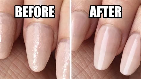 How To Get Rid Of Bubbles In Nails