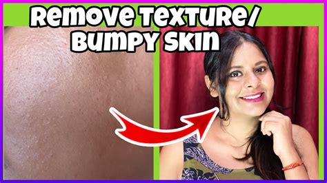 how to get rid of bumpy face