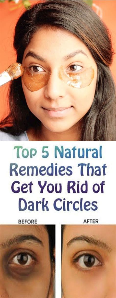 How To Get Rid Of Dark Circles In A Day