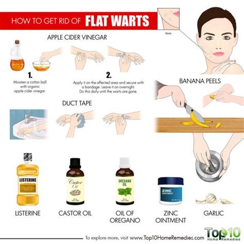 how to get rid of flat warts