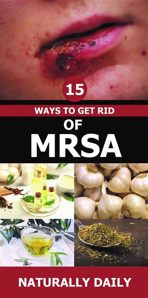 How To Get Rid Of Mrsa In Your Home