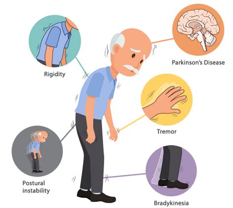 how to get rid of parkinson's disease