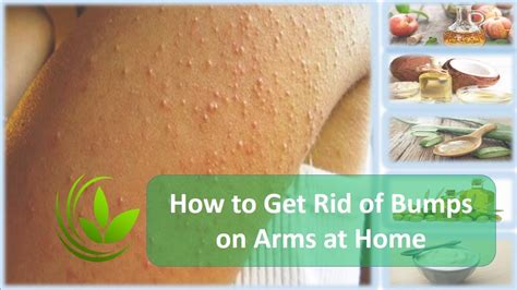 How To Get Rid Of Red Bumps On Armpits From Shaving