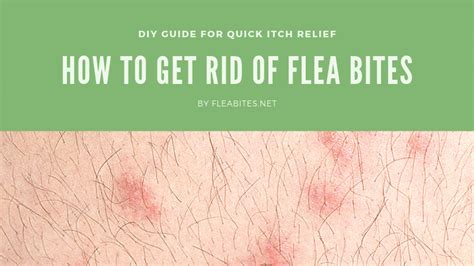 How To Get Rid Of Red Flea Bite Marks