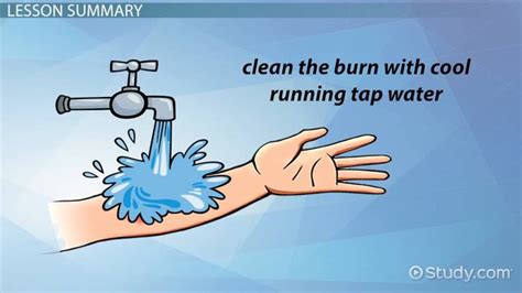 How To Get Rid Of Rope Marks