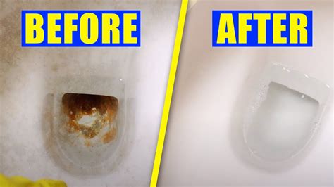 How To Get Rid Of Stains In Toilets