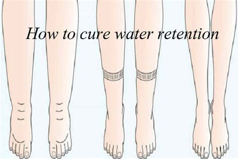 How To Get Rid Of Water Retention From Gabapentin