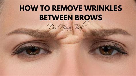 6 Ways To Treat Wrinkles On Your Forehead Wrinkles remedies face