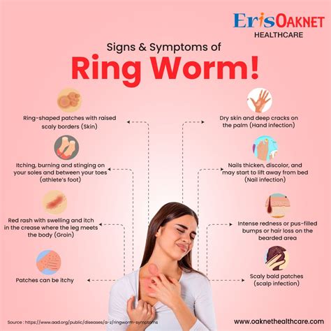 Understanding and Preventing Ringworm: A Guide on How to Get Ringworm and What to Do Next