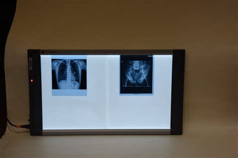 How To Get To The X Ray Light Box