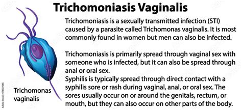 Understanding Trichomoniasis: A Guide on How to Get Tested and Treated for the Infection