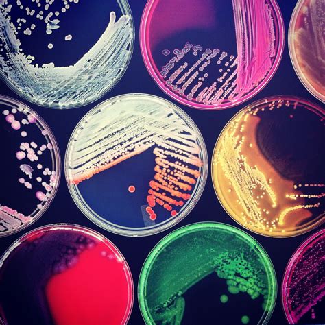 how to grow bacteria on agar plates