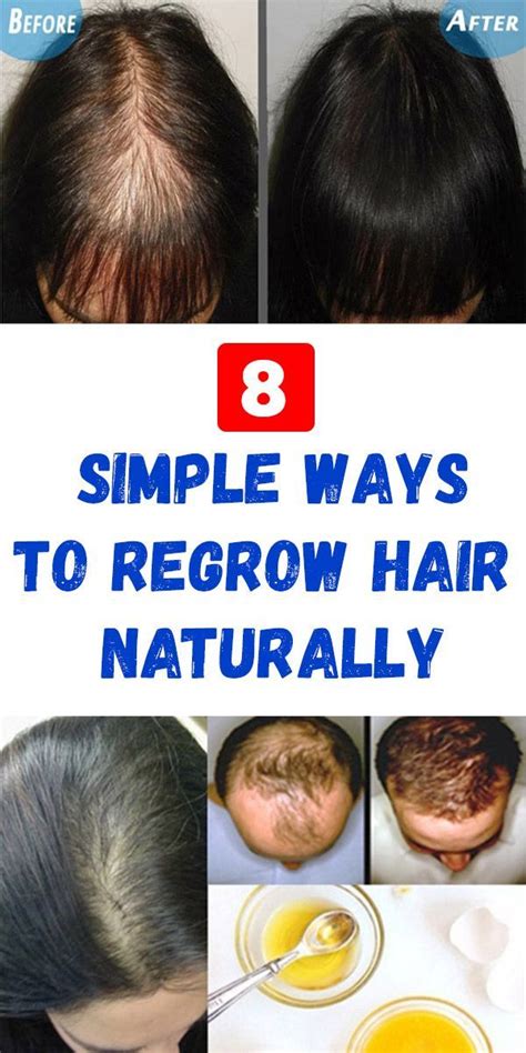 How To Grow Hair On Bald Spots  A Comprehensive Guide