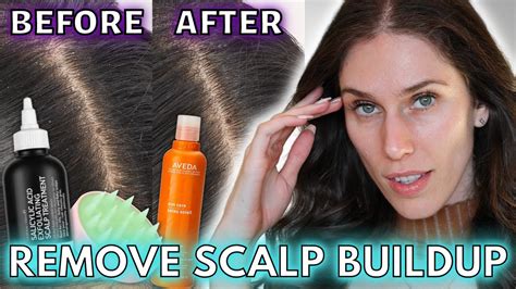 How To Hide Scalp  Tips And Tricks