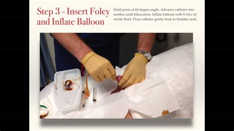 How To Insert In And Out Catheter