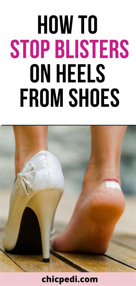 How To Keep Shoes From Causing Blisters