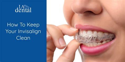 How To Keep Teeth Clean With Invisalign
