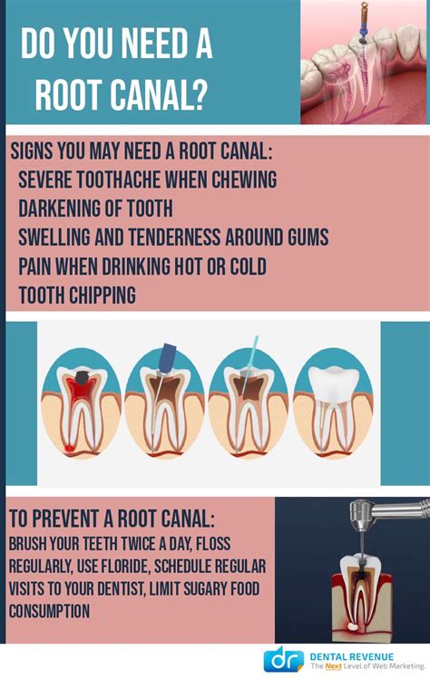 PPT 12 Signs You May Need A Root Canal PowerPoint Presentation, free