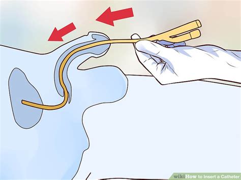How To Learn To Insert Catheter
