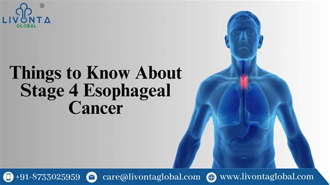 how to live with esophageal cancer