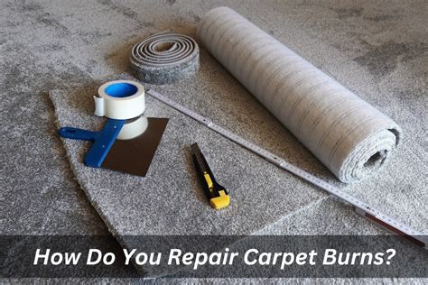How To Make A Carpet Burn Feel Better