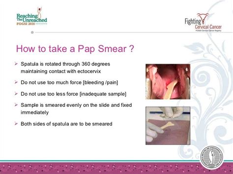 how to make a smear test less painful