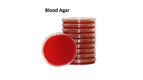 how to make blood agar