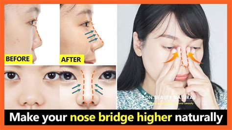 how to make your nose bridge higher