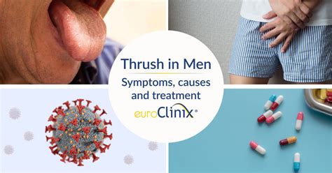 how to men get thrush