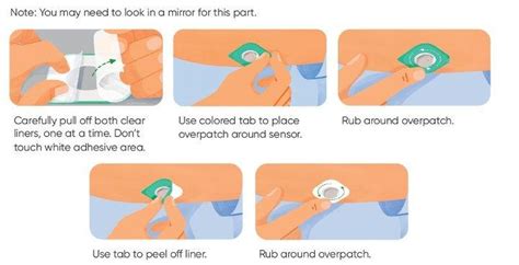 how to place g7 sensor