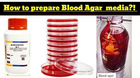 how to prepare blood agar