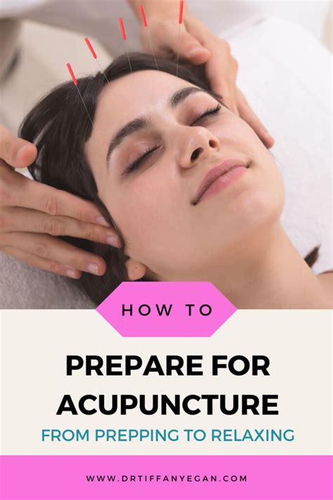 how to prepare for acupuncture