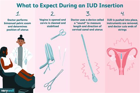 how to prepare for an iud insertion