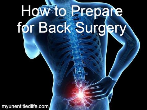 how to prepare home after back surgery