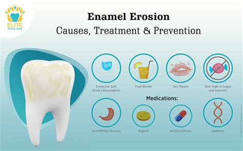 How To Prevent Enamel Damage