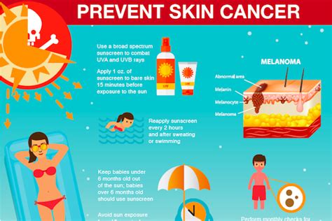 how to prevent melanoma cancer