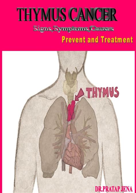 how to prevent thymus cancer